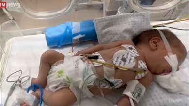 أنفاس معدودة للأطفال الخدج الفلسطينيين في مستشفى شهداء الأقصى بغزة / تقرير خاص