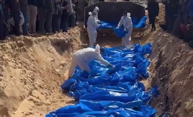 ارتفاع عدد ضحايا سوء التغذية والجفاف في غزة إلى 23 شخصا