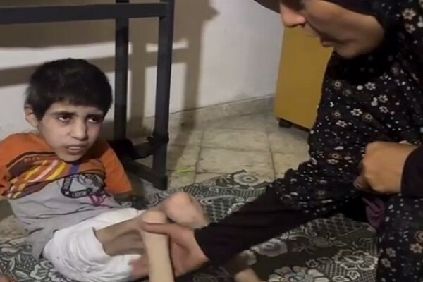 صور صادمة لمحنة الطفل الفلسطيني نتيجة الجوع الشديد